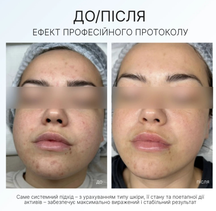 КРЕМ-ГЕЛЬ CLEAR AG SKIN CLEAR CREAM GEL, 50 мл