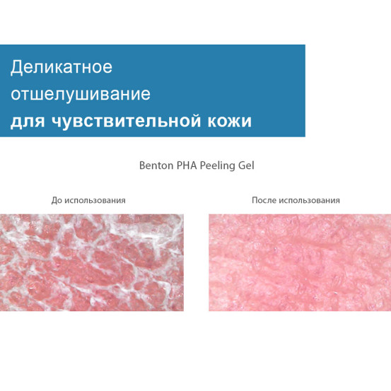 Пілінг-гель з лактобіоновою кислотою Benton PHA Peeling Gel, 70 мл