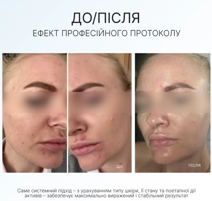 ЗВОЛОЖУЮЧИЙ ОЧИЩУВАЛЬНИЙ ГЕЛЬ AG SKIN MOISTURIZING CLEANSING GEL, 250 мл