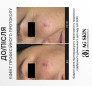 СУДИНОЗМІЦНЮЮЧА СИРОВАТКА AG SKIN ANTI-REDNESS SERUM, 30 мл